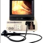 endoscopy