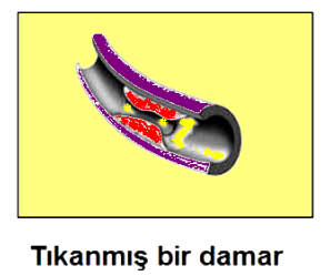 damar1 damar1