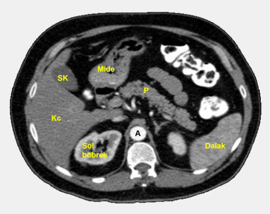 pancreas1
