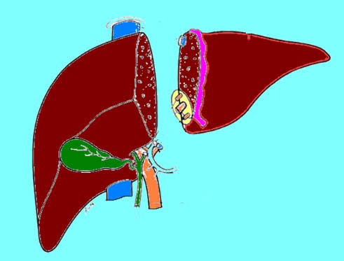 transplantasyon6