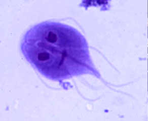 Giardia-fertőzés (giardiasis) Lamblia parazita nedir